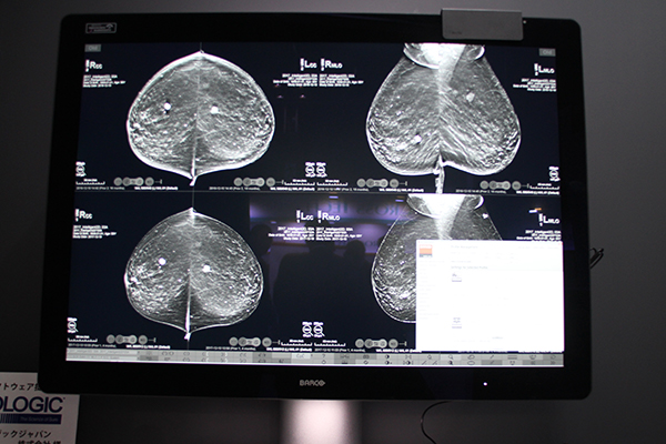 12メガピクセルの医用画像表示ディスプレイCoronis Uniti