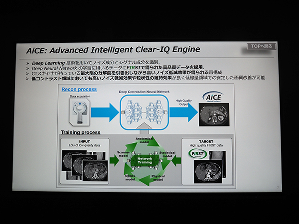 AIを用いたCT再構成技術「AiCE（Advanced Intelligent Clear-IQ Engine）」を発表