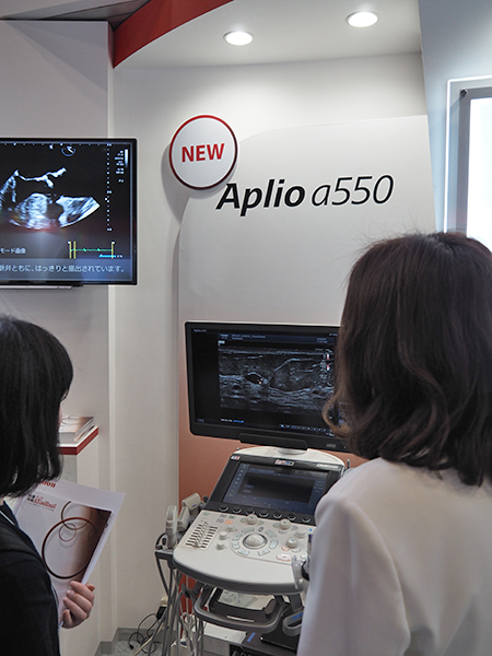 超音波診断装置のハイエンドシリーズ「Aplio a-series」
