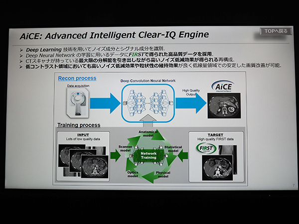 ディープラーニング技術によるCT画像再構成技術の「AiCE（Advanced Intelligent Clear-IQ Engine」
