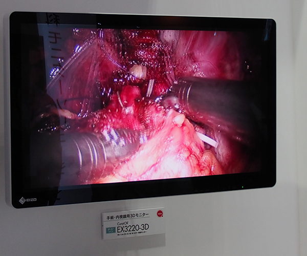 手術・内視鏡用3Dモニター「CuratOR EX3220-3D」