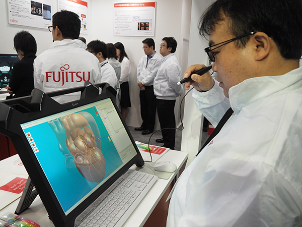 Heart Explorerは三次元立体視ディスプレイを使うことでの3Dによる立体視も可能