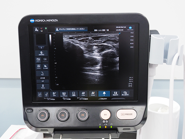 整形外科向けの最新超音波診断装置「SNiBLE yb」