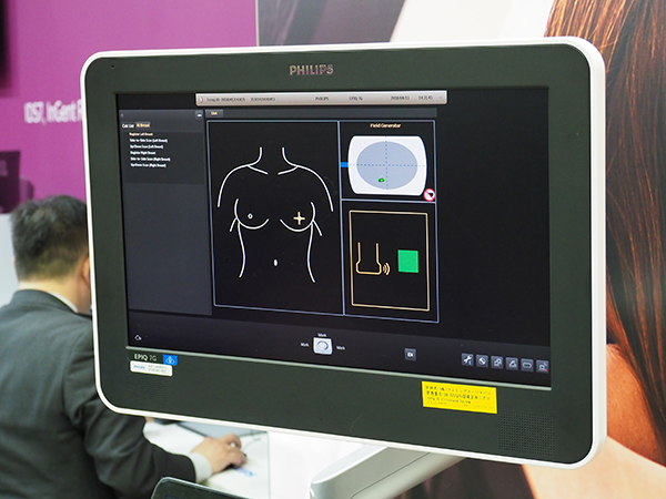 “AI Breast機能”ではトランスジューサの走査位置を表示