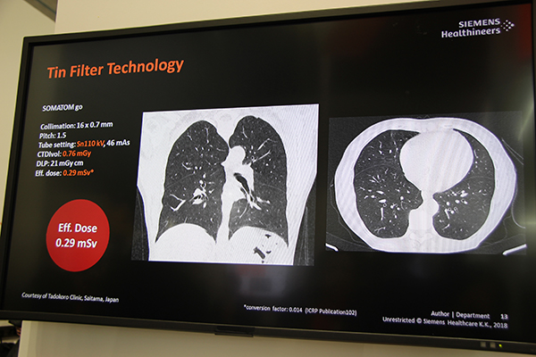 Tin Filter技術により一般的な胸部X線撮影と同等の線量で撮影可能