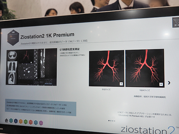 超高精細CTに対応する「Ziostation2 1K Premium」