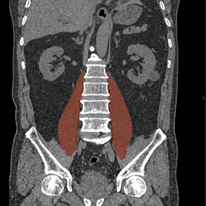 図5：非造影の臓器や筋肉なども抽出可能
