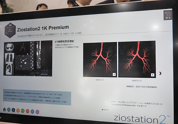 1Kデータの大容量データで高精細画像の処理を可能にする「Ziostation2 1K Premium」