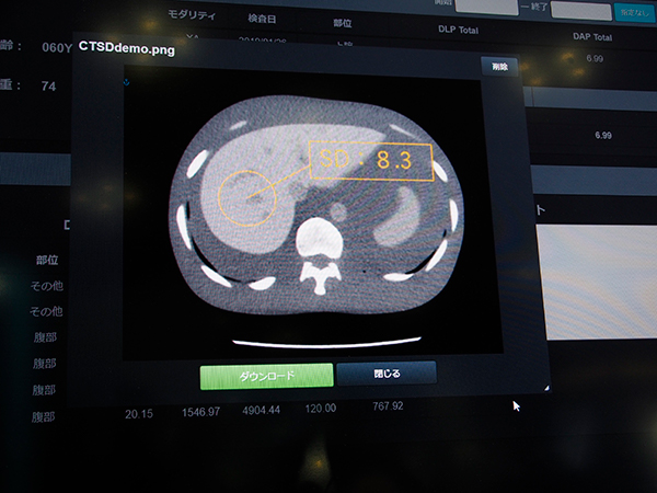 画質を担保できていることを確認可能なSD画像添付機能