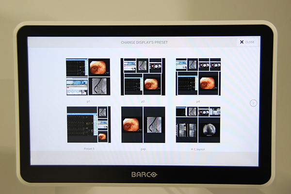 検査室内のディスプレイの映像を，ネットワークに接続したタブレットで操作できる。