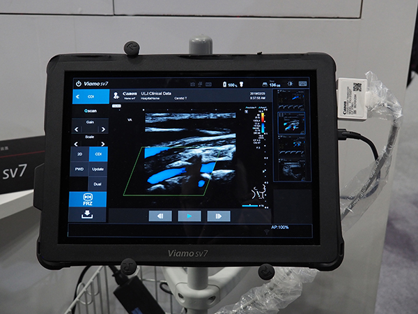 タブレット型超音波診断装置「Viamo sv7」がITEM初出展