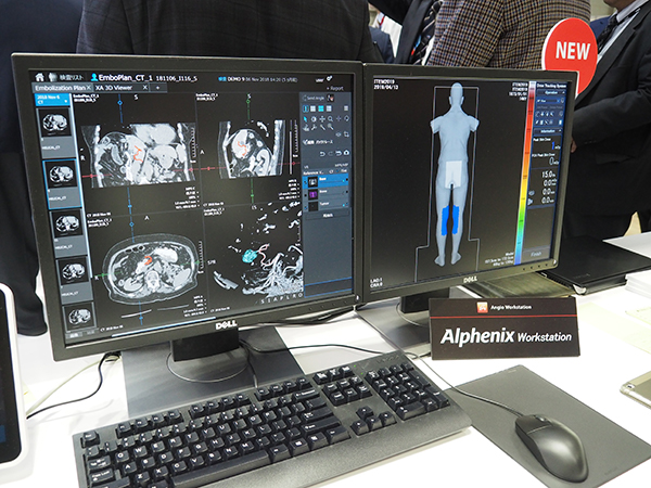「Alphenix Workstation」の“Embolization Plan”では複数の腫瘍の栄養血管を描出可能