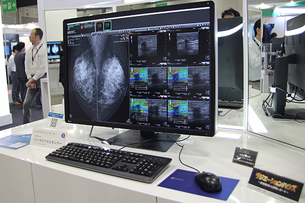 開発中の12メガピクセルモニタ医用画像表示カラーマルチモダリティモニタ