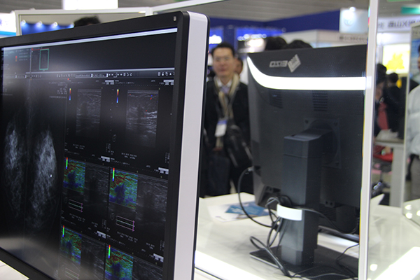 読影室向け間接照明「RadiLight」を背面に内蔵予定。書類の読み書きやキーボード操作時に有用な手元照明を付属し，いずれも手元で手軽に操作できる。また，モニタサイズを小さくかつ薄くするなど，コンパクトな設計になっている。