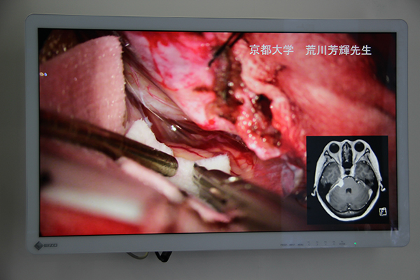 4K表示対応32型ワイド手術用モニタ「CuratOR EX3241」