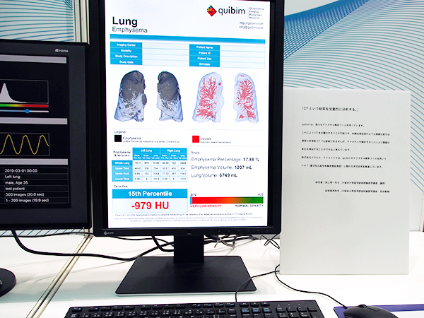 AI“quibim”（研究用用途）による肺機種解析の定量化レポート