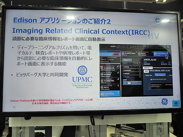 読影の優先順位づけをする“Imaging Related Clinical Context（IRCC）”