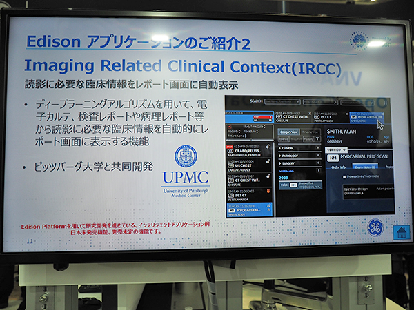 「Centricity Universal Viewer」への搭載を予定している“Imaging Related Clinical Context（IRCC）”