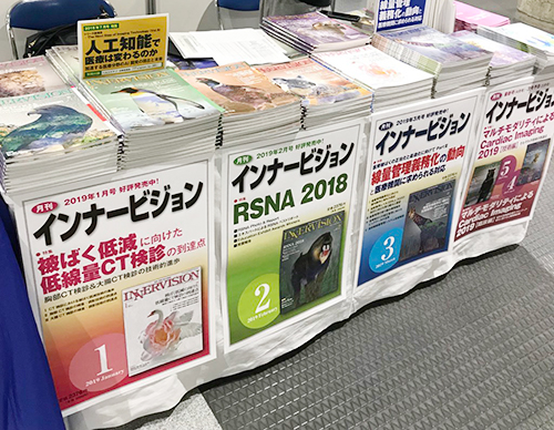 インナービジョン販売