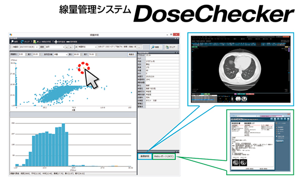 線量管理システム「DoseChecker」