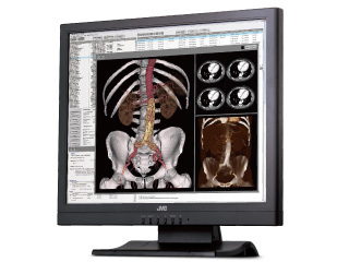 汎用性の高い19型1.3メガピクセルモニター