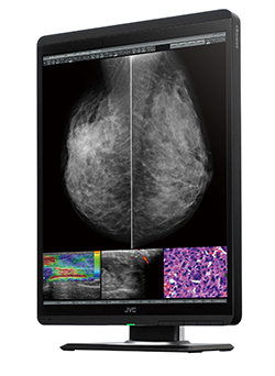 マンモグラフィ画像表示用5メガピクセルモニター