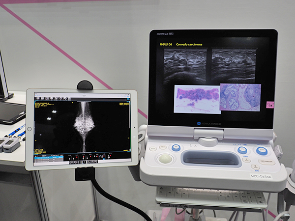 乳がん検診ワークフロー「CADnavi」では，「FINO.View.air」で画像を参照しながら超音波診断装置「SONIMAGE HS1」での検査を提案