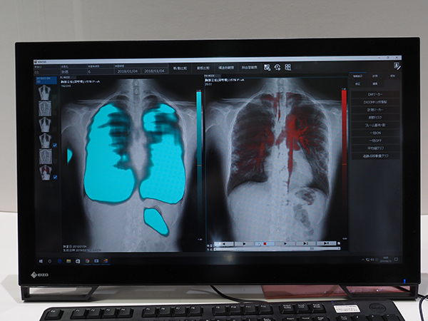 呼吸に伴う肺野内の濃度変化をとらえる“PL-MODE”（左）と心拍による肺野内の信号変化を動画で確認できる“PH-MODE”