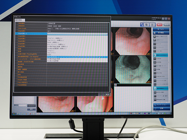 内視鏡レポート作成ソフトウエアを搭載した診療所向けの画像診断ワークステーション「Unitea α」