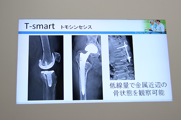 “T-smart”機能により，低線量で金属（人工関節）近辺の骨の状態を観察できる