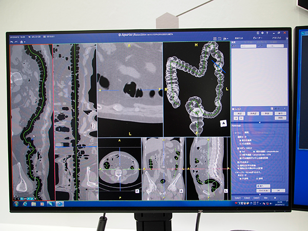 CRP view上でパス修正が可能な大腸CT解析