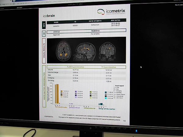 MRIから脳容積などを定量化する脳画像解析