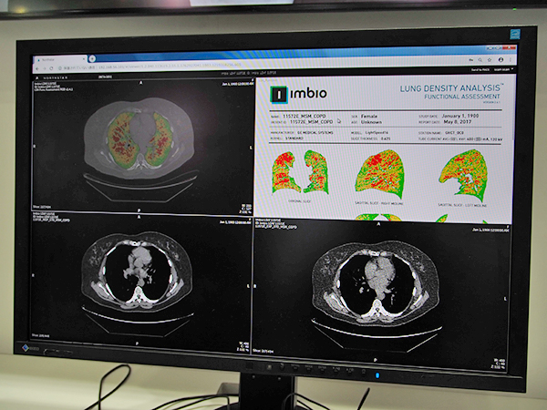胸部CT画像を用いた肺機能解析