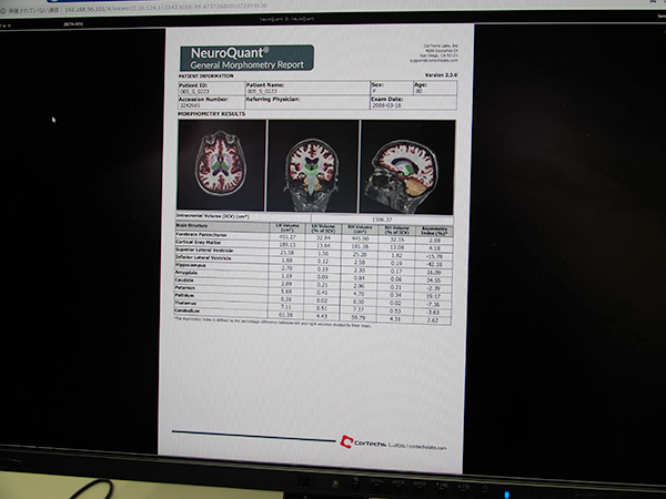 頭部MRIの脳機能解析