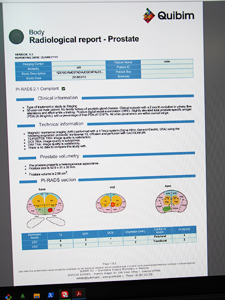 PI-RADS ver2に準拠したレポートを出力できる“qp-Prostate”