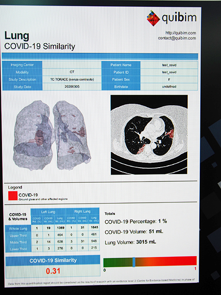 COVID-19の罹患度を算出する“COVID-19 Similality”