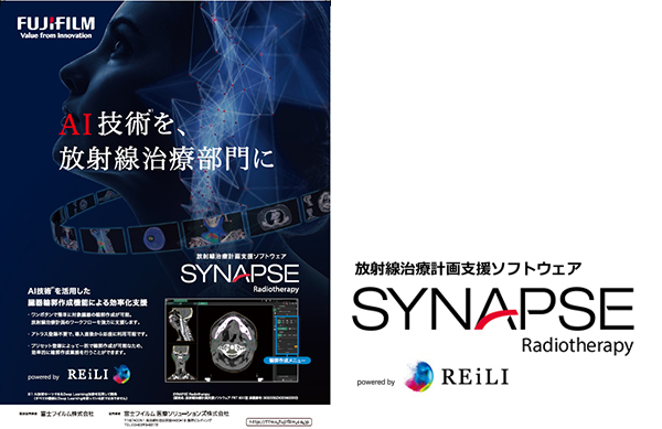 SYNAPSE Radiotherapy