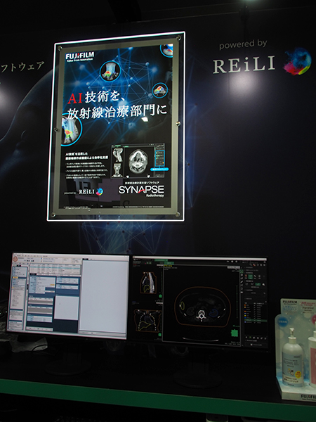 REiLIの機能を搭載した放射線治療計画支援ソフトウェア「SYNAPSE Radiotherapy」
