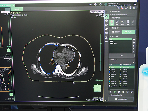 臓器セグメンテーション技術を応用して臓器輪郭の描出を支援