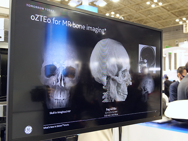骨を描出するアプリケーション“oZTEo”