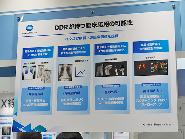 デジタルX線動画撮影システム（DDR）は各領域での臨床応用が期待される