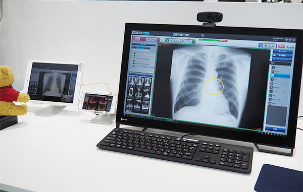 インテグリティヘルスケア社のオンライン診療システム「YaDoc」。画像や検査結果の共有なども可能（左のタブレットが患者側）
