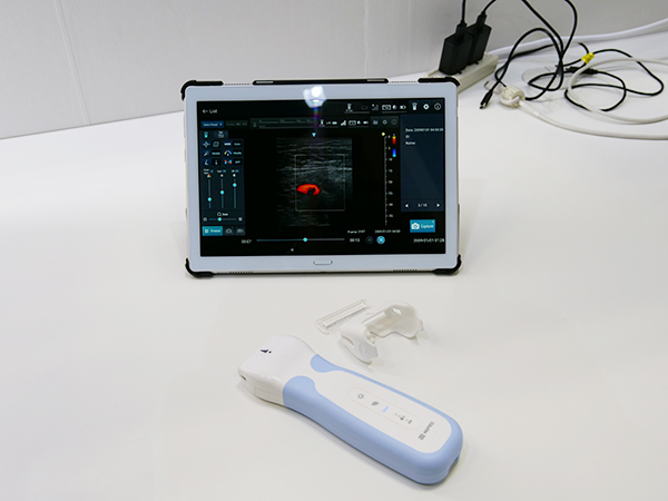 ワイヤレスプローブ採用のタブレット型超音波診断装置「ECHOMO」
