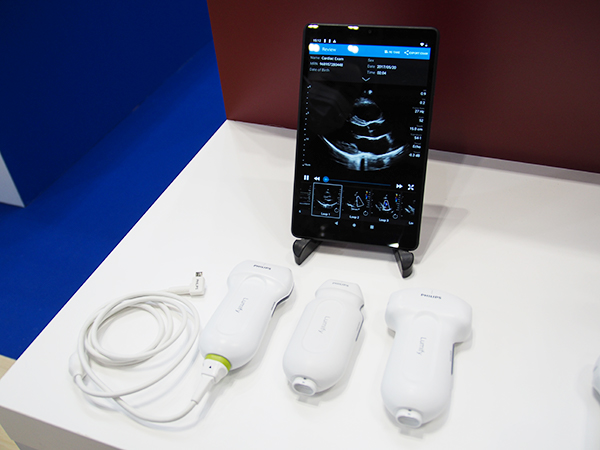 携帯型超音波診断装置「Lumify」
