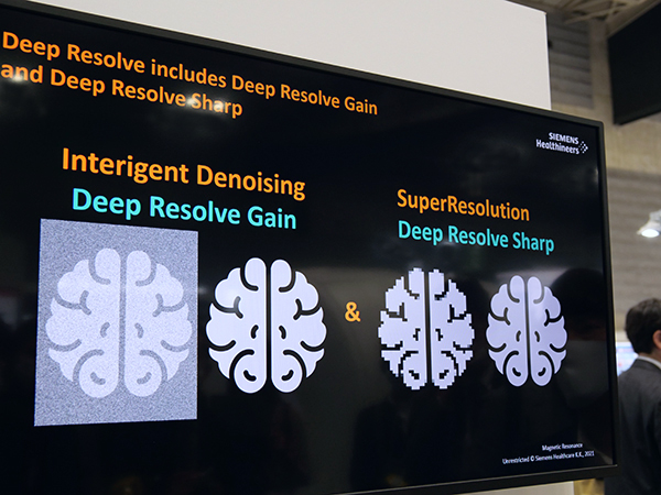 ディープラーニングを用いたMRIの画像再構成技術“Deep Resolve”