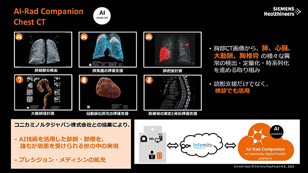 “AI-Rad Companion Chest CT”は肺や心臓，大動脈，胸椎骨の各種解析機能を用意