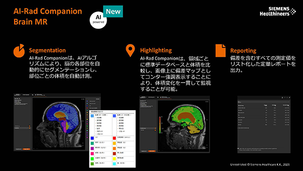 アルツハイマー型認知症などの評価に役立つ“AI-Rad Companion Brain MR”