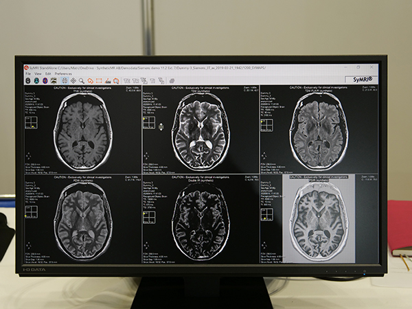 「SyMRI NEURO」で取得可能なマルチコントラスト強調画像
