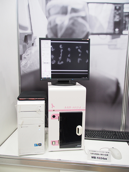 X線乳腺組織画像表示装置「MB-1024DR」