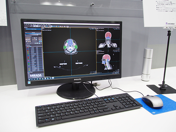 Workflow Boxによる頭頸部腫瘍の自動輪郭描画後の画像